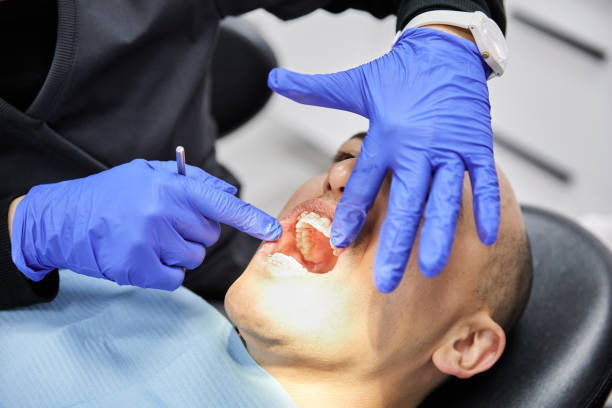 Best Emergency Tooth Extraction in Navy, VA